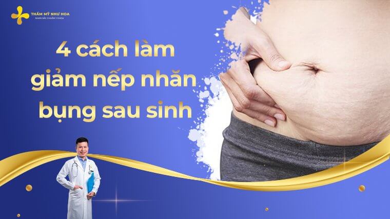 Cach Lam Giam Nep Nhan Bung Sau Sinh Avt