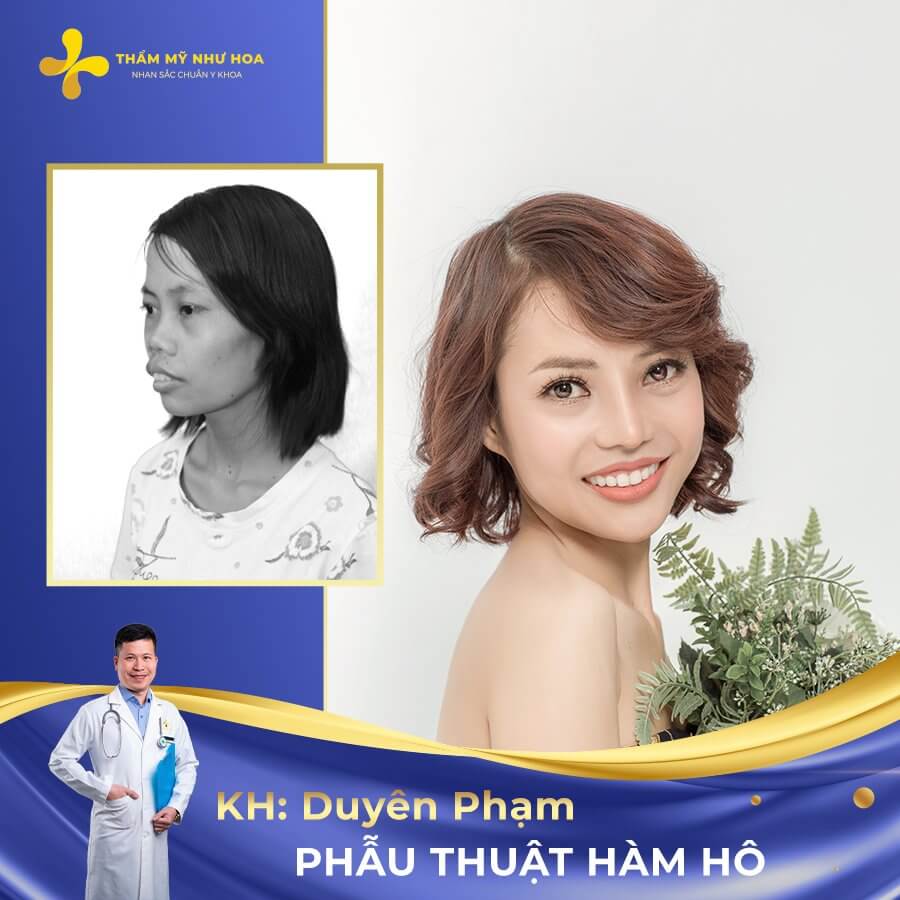 Khach Hang Phau Thuat Ham Ho 08