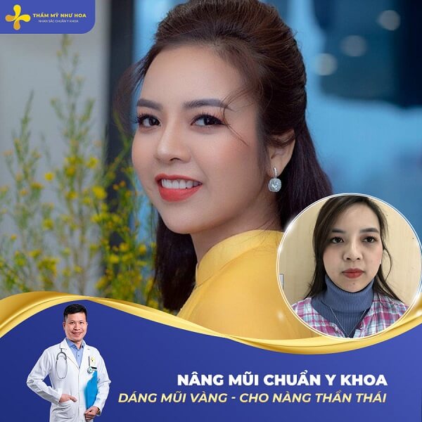 Nang Mui Anh Huong Suc Khoe Khong 1 (1)