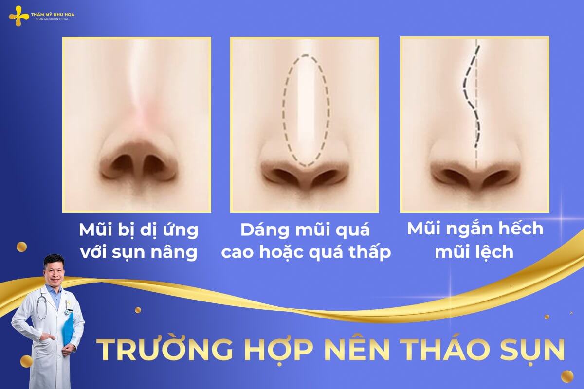 Nang Mui Xong Co Thao Sun Duoc Khong 2 (1)