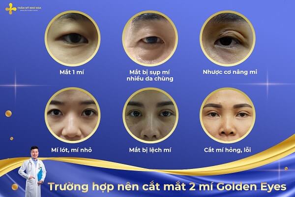 Truong Hop Cat Mat 2 Mi Golden Eyes